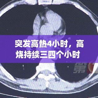突发高热4小时，高烧持续三四个小时 